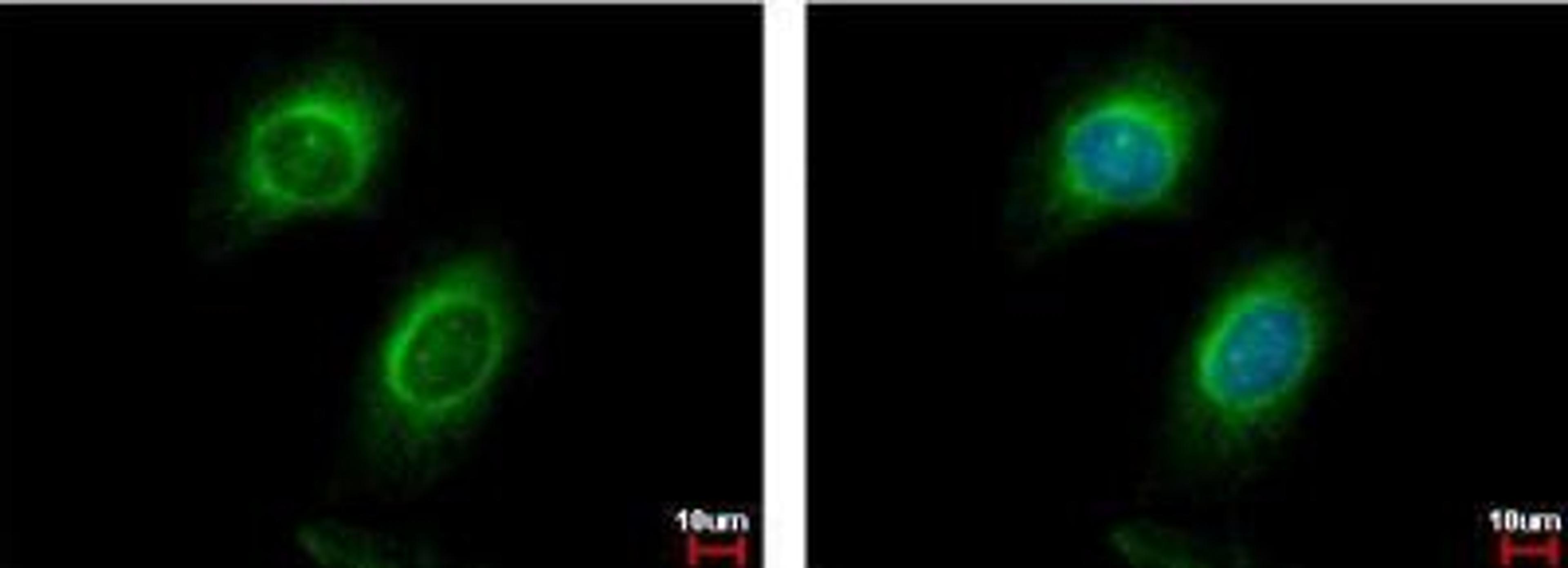 Immunocytochemistry/Immunofluorescence: CD130 Antibody [NBP2-15776] - HeLa cells.