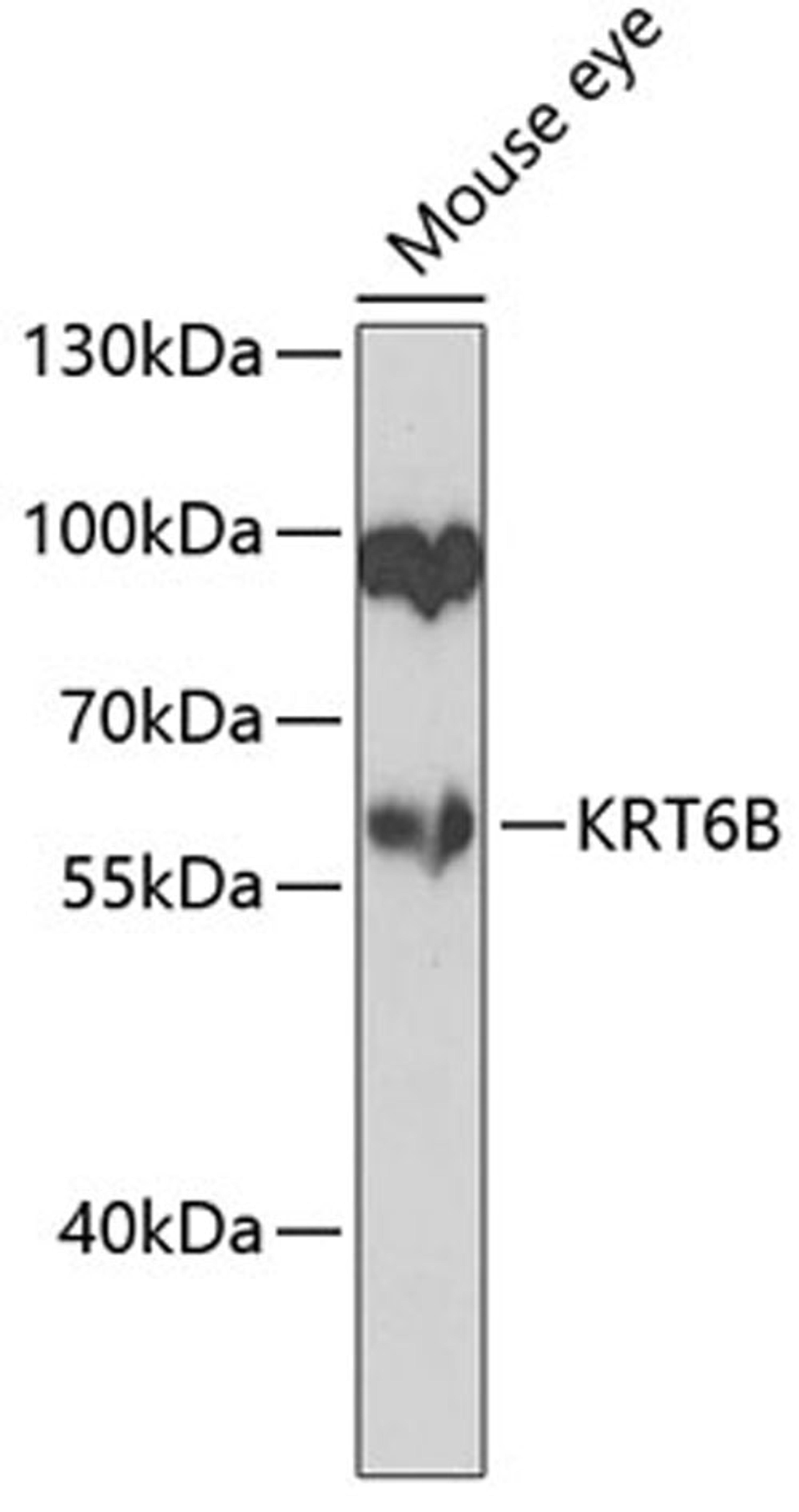 Western blot - KRT6B antibody (A7696)