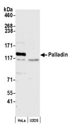 Detection of human Palladin by western blot.