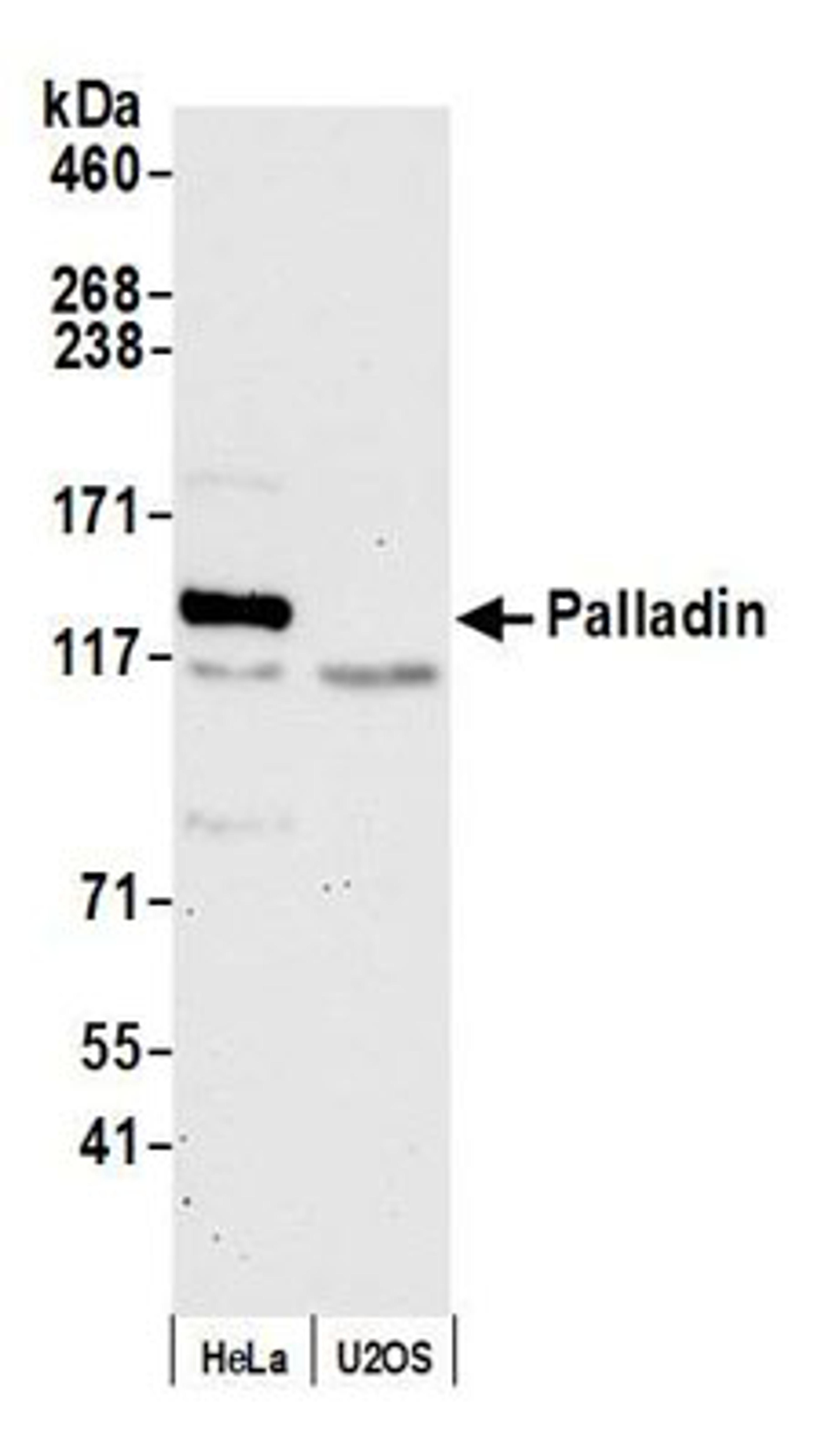 Detection of human Palladin by western blot.