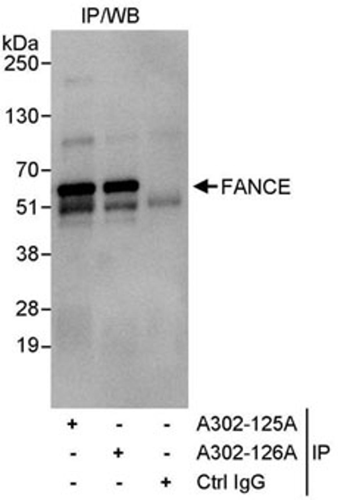 Detection of human FANCE by western blot of immunoprecipitates.