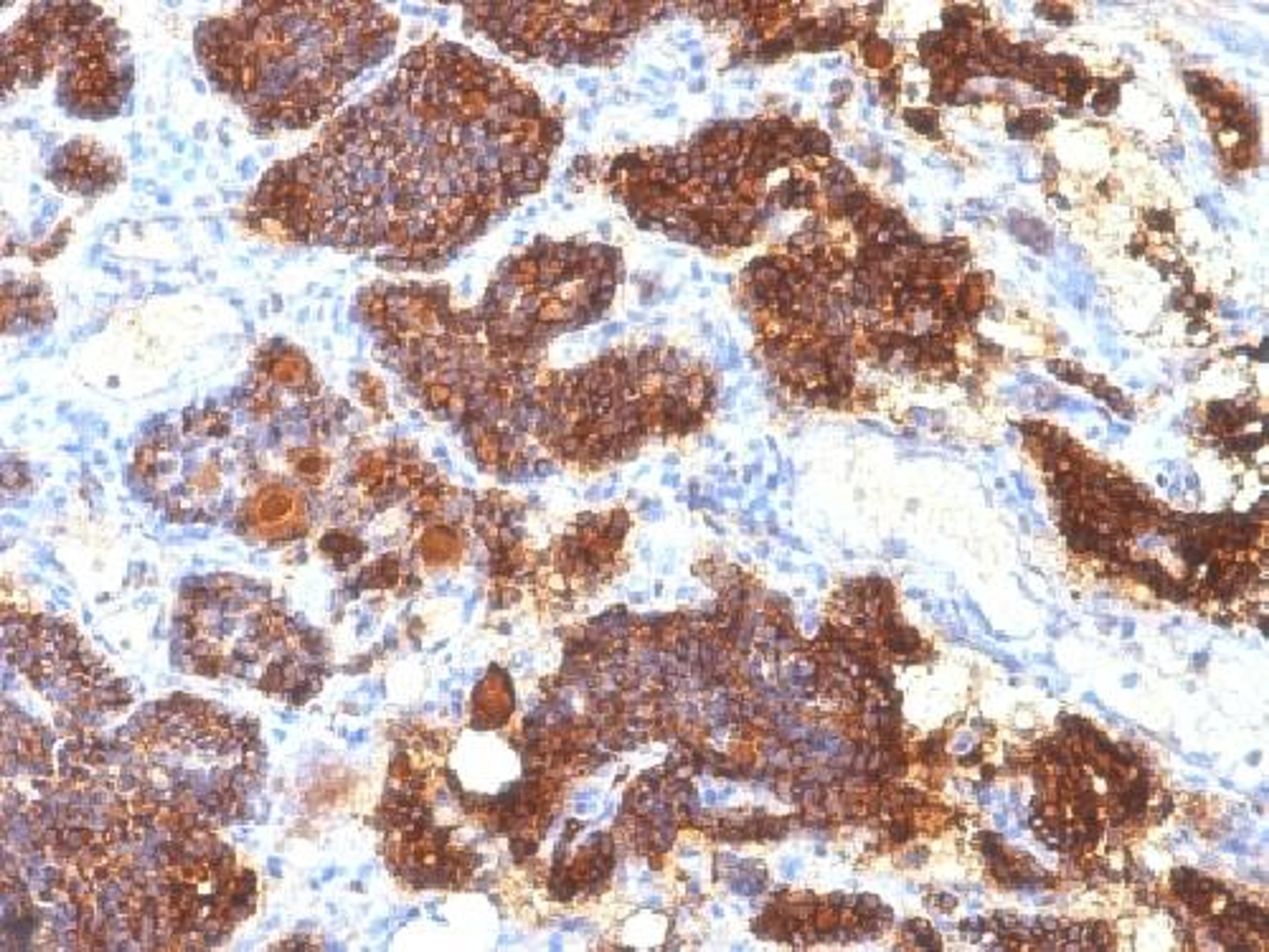 Immunohistochemical staining of human Parathyroid tissue using PTH antibody