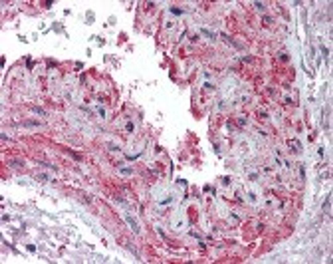 Immunohistochemistry staining of beta Actin in skeletal muscle, vessel tissue using beta Actin Antibody.