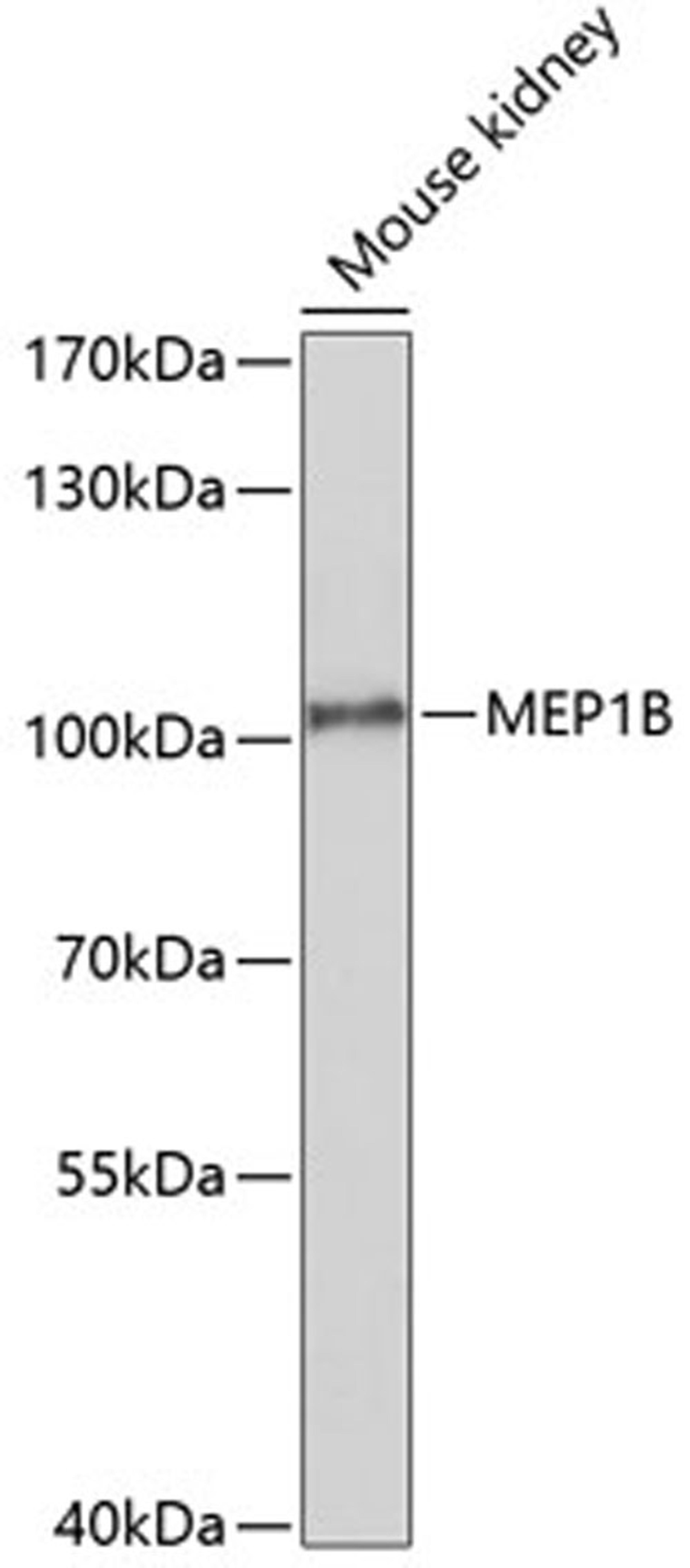 Western blot - MEP1B antibody (A10085)