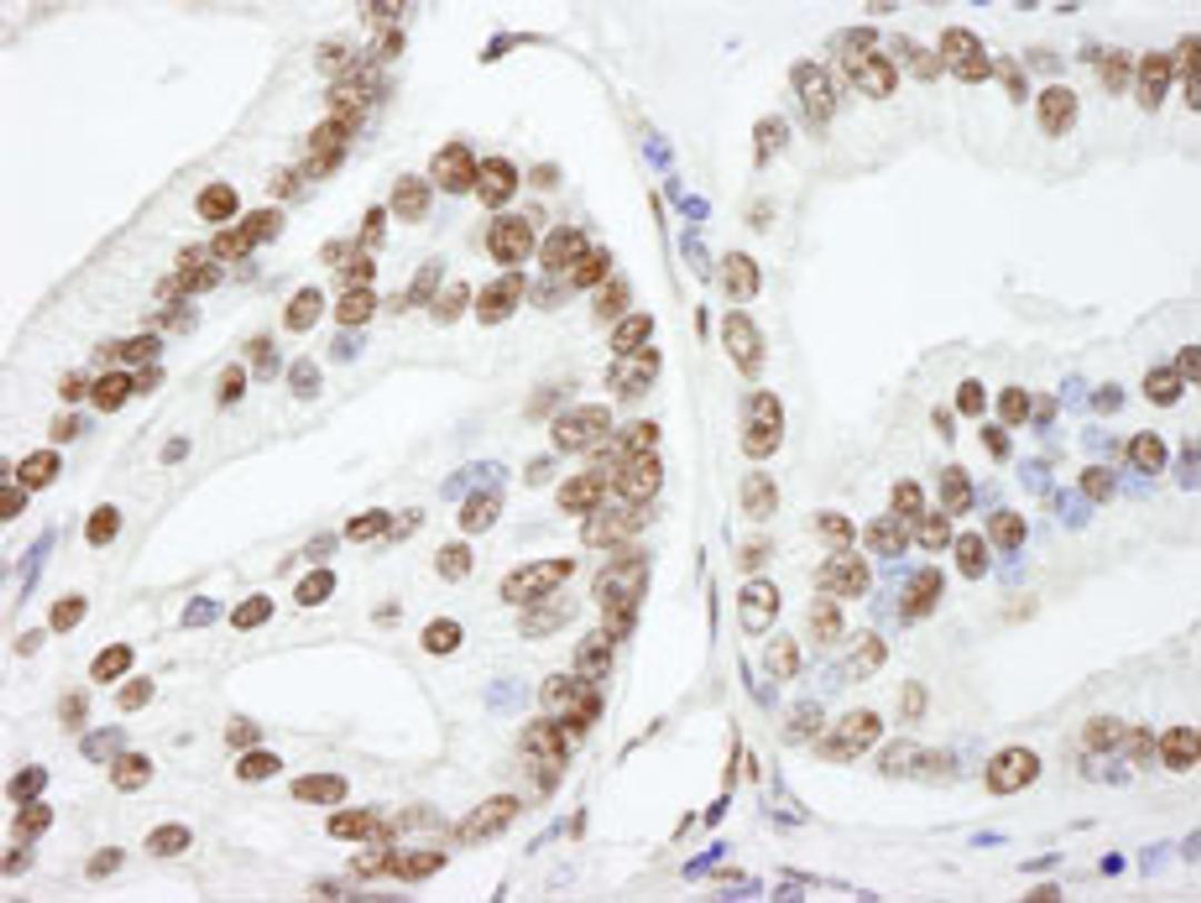 Detection of human NUCKS by immunohistochemistry.