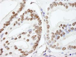 Detection of human NUCKS by immunohistochemistry.