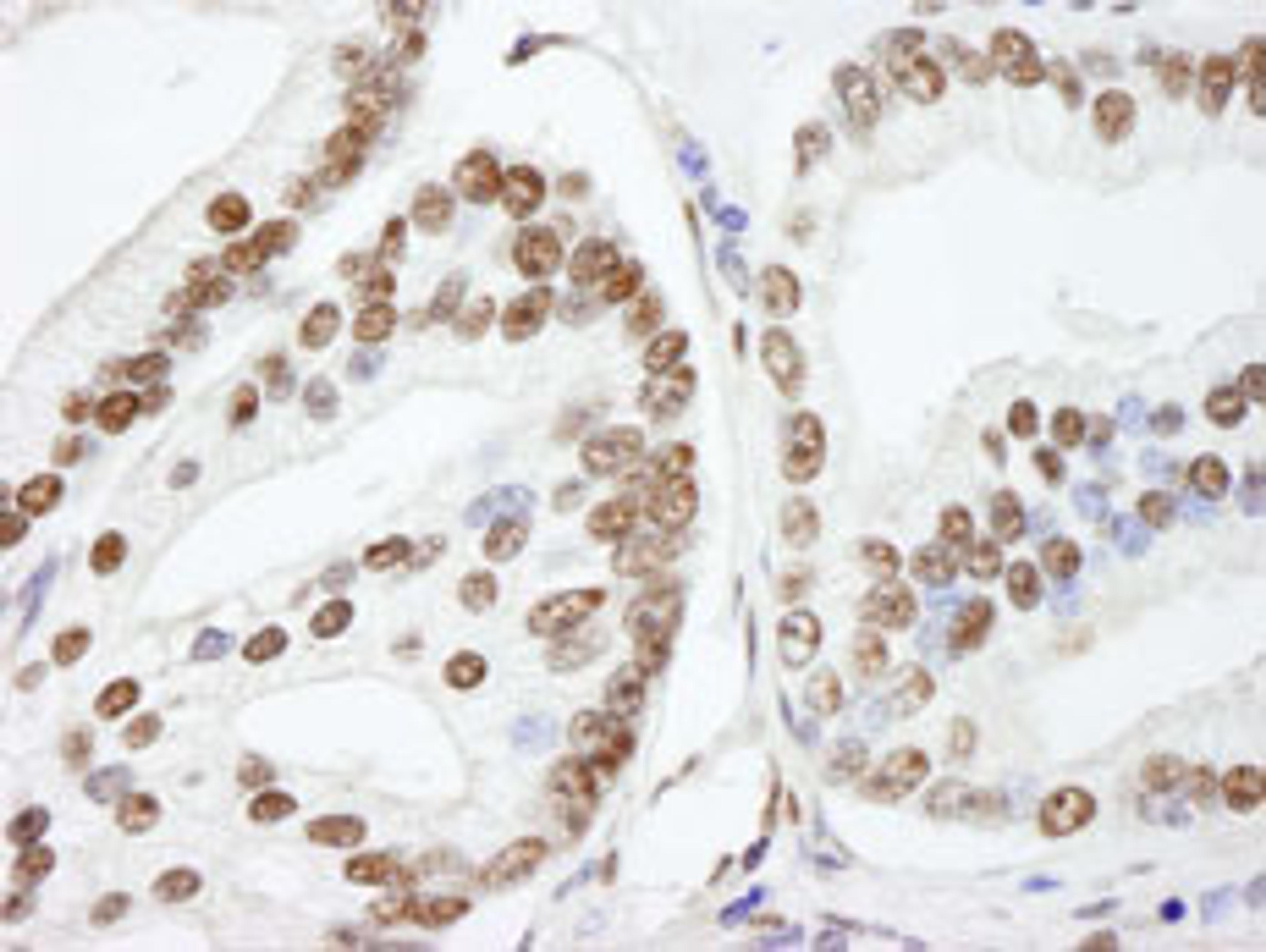 Detection of human NUCKS by immunohistochemistry.