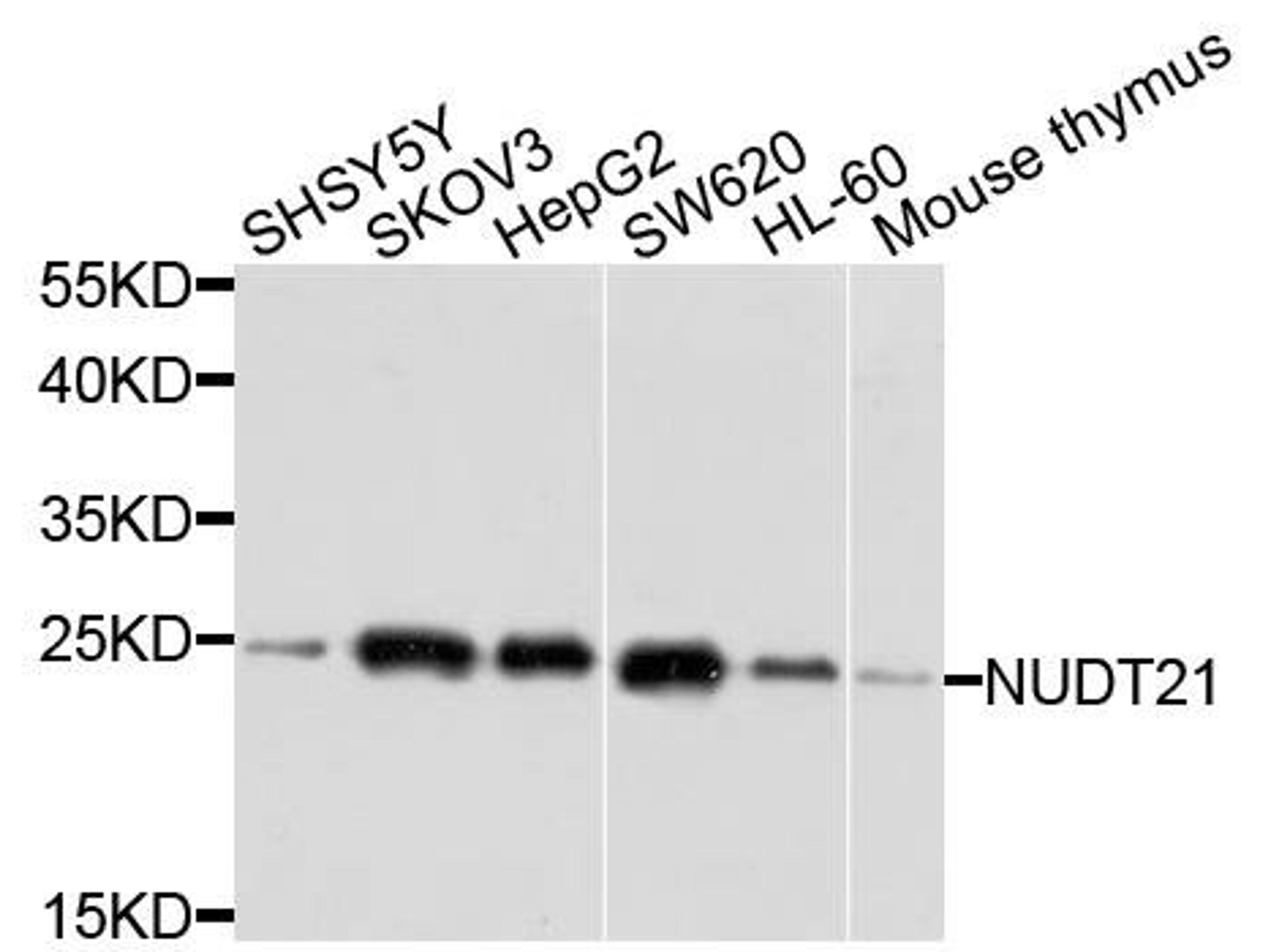 Western blot analysis of extracts of various cells using NUDT21 antibody