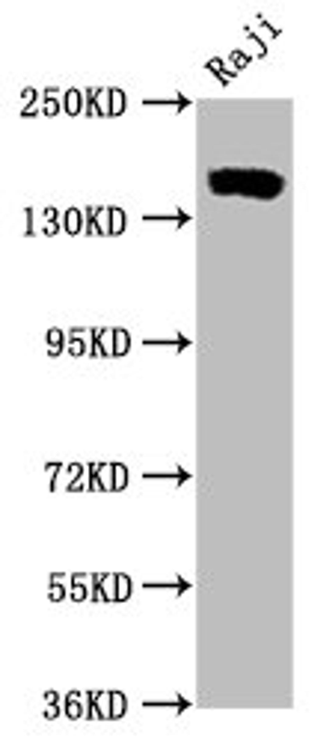 Western Blot. Positive WB detected in Raji whole cell lysate. All lanes CD21 antibody at 0.55μg/ml. Secondary. Goat polyclonal to rabbit IgG at 1/50000 dilution. Predicted band size: 155 KDa. Observed band size: 155 KDa. 