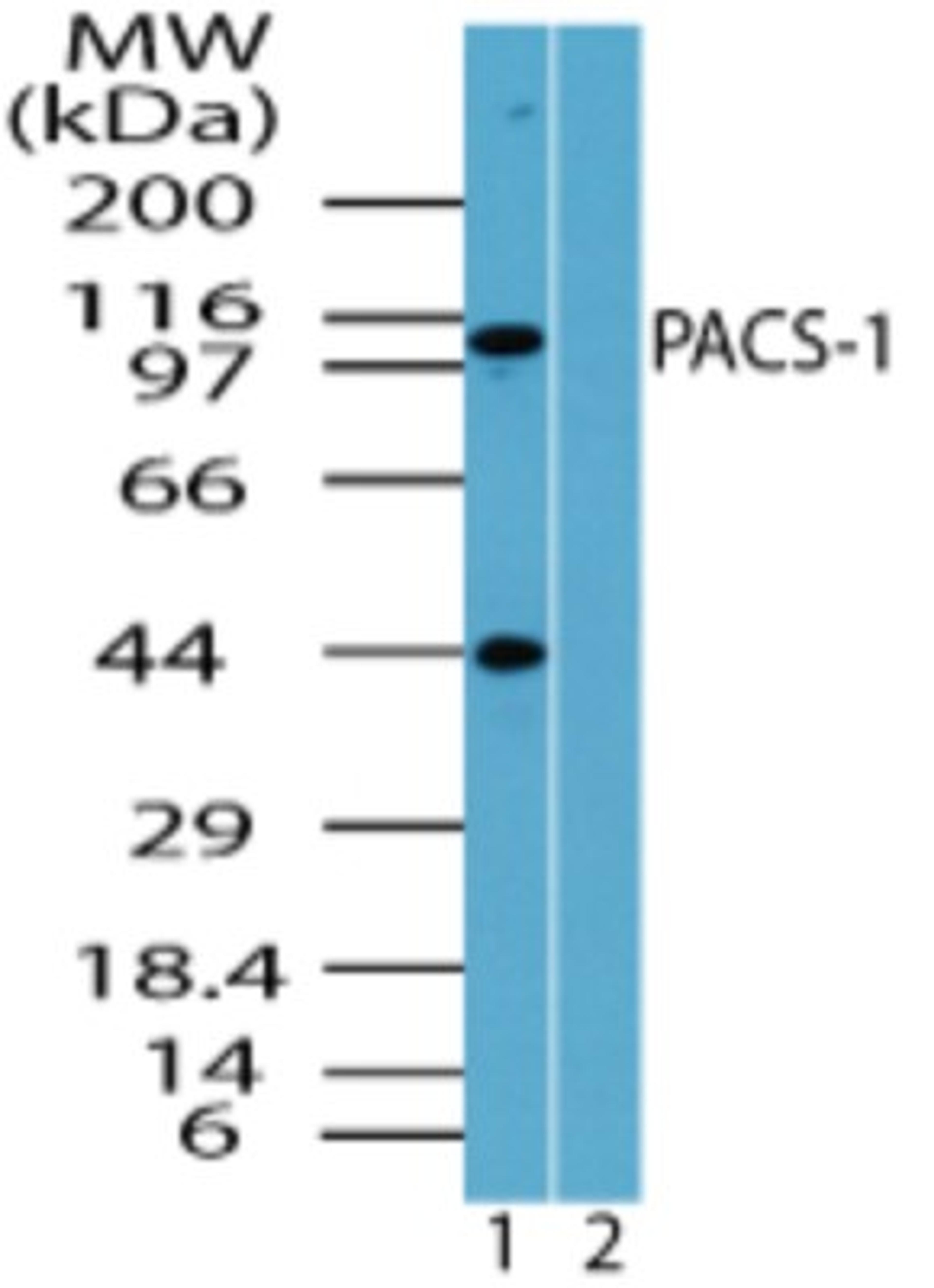 Western Blot: PACS1 Antibody [NBP2-24496] - Analysis of PACS-1 in human uterus lysate in the 1) absence and 2) presence of immunizing peptide using this antibody at 0.05 ug/ml.