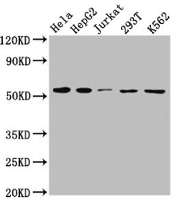 Western Blot. Positive WB detected in: Hela whole cell lysate, HepG2 whole cell lysate, Jurkat whole cell lysate, 293T whole cell lysate, K562 whole cell lysate. All lanes: MCT1 antibody at 1:1000. Secondary. Goat polyclonal to rabbit IgG at 1/50000 dilution. Predicted band size: 54, 47 kDa. Observed band size: 54 kDa. 