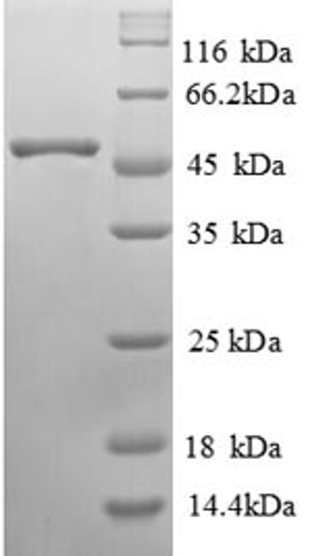 (Tris-Glycine gel) Discontinuous SDS-PAGE (reduced) with 5% enrichment gel and 15% separation gel.
