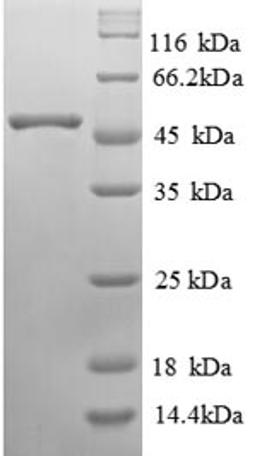 (Tris-Glycine gel) Discontinuous SDS-PAGE (reduced) with 5% enrichment gel and 15% separation gel.