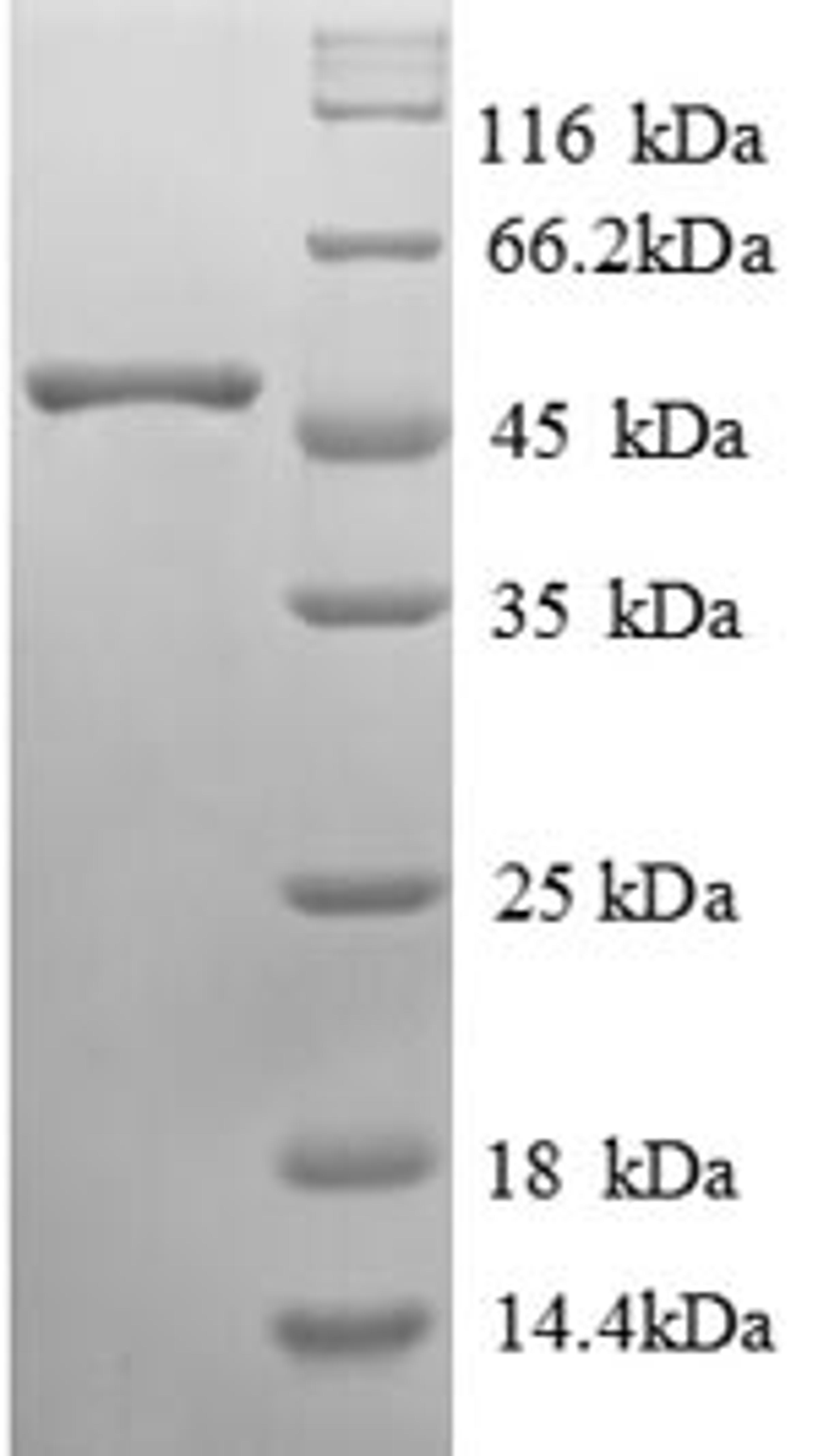 (Tris-Glycine gel) Discontinuous SDS-PAGE (reduced) with 5% enrichment gel and 15% separation gel.