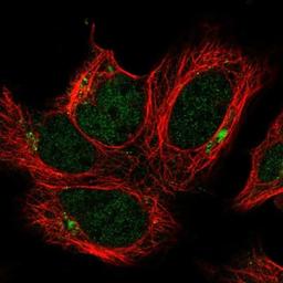 Immunofluorescence: FAM125A Antibody [NBP1-91883] - Staining of human cell line HEK 293 shows positivity in nucleus but not nucleoli & aggresome.