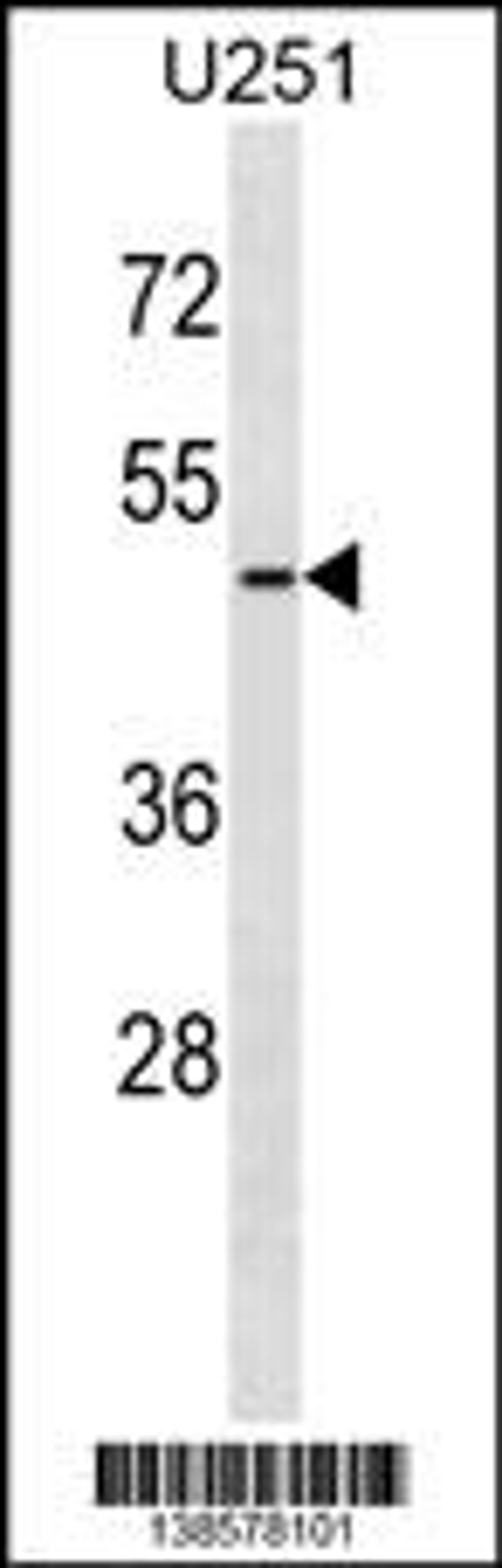 Western blot analysis in U251 cell line lysates (35ug/lane).