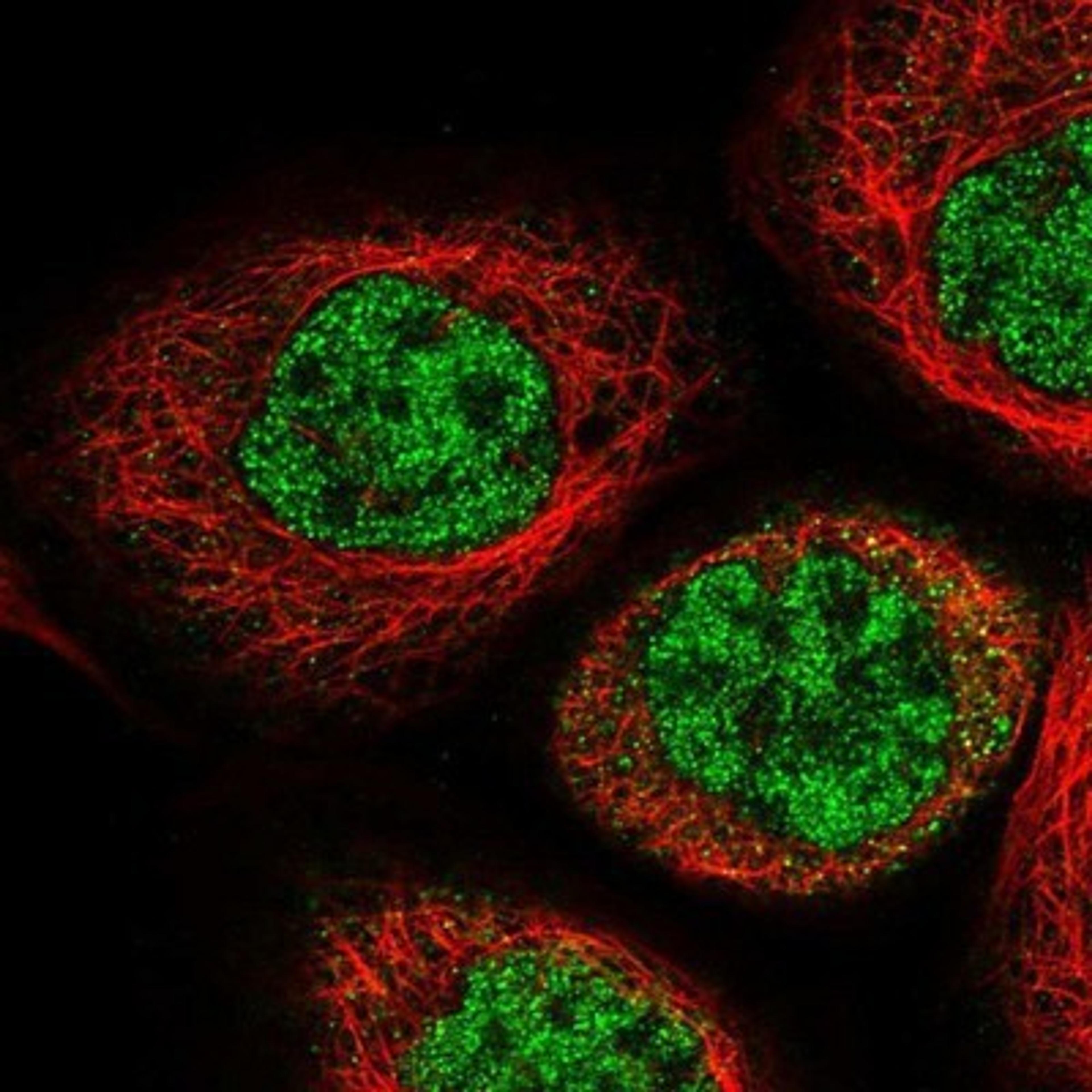 Immunocytochemistry/Immunofluorescence: IPMK Antibody [NBP1-89426] - Staining of human cell line A-431 shows positivity in nucleus but not nucleoli.