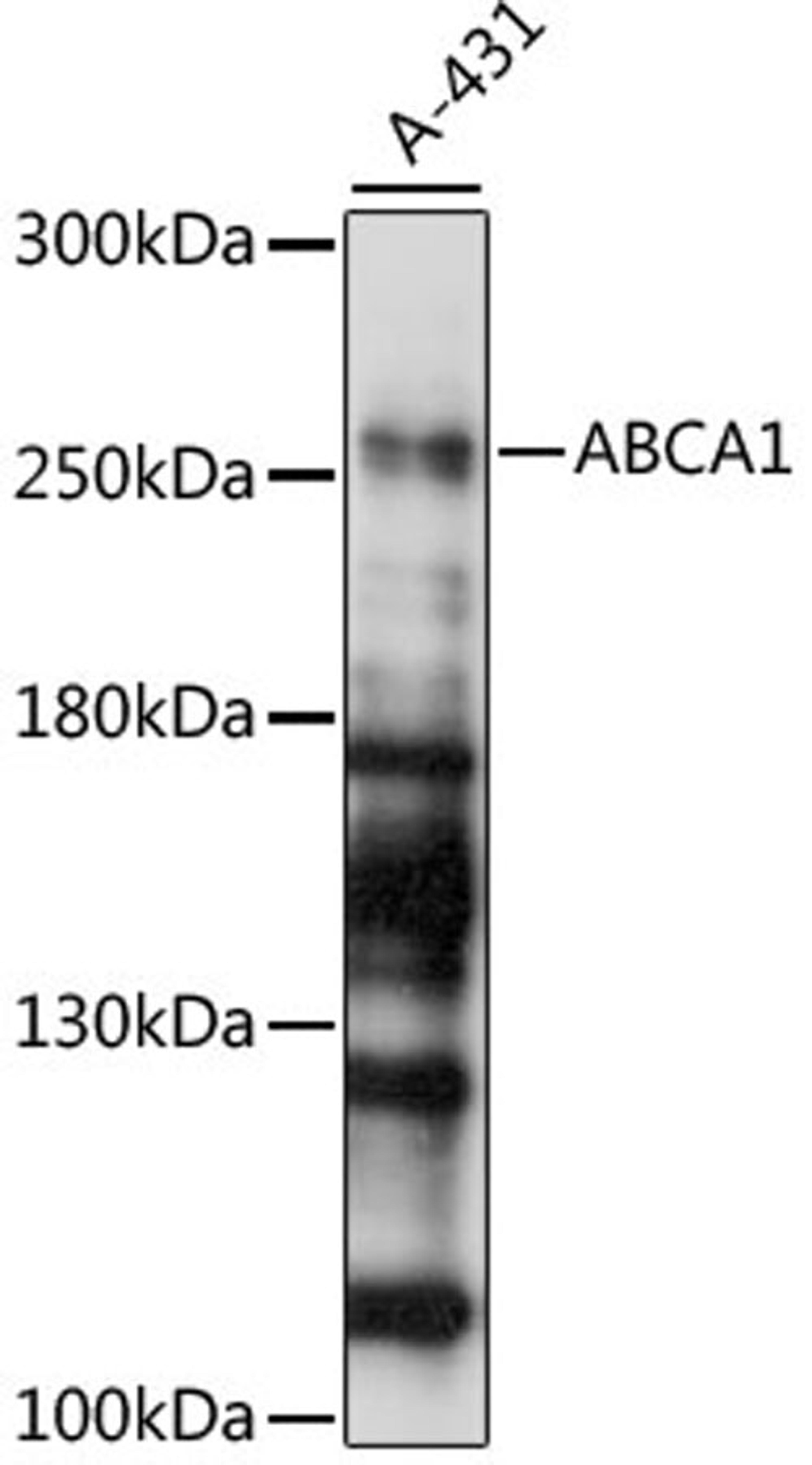 Western blot - ABCA1 antibody (A7228)