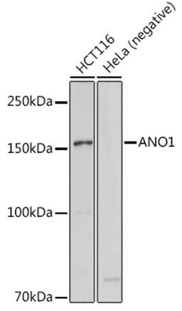 Western blot - ANO1 antibody (A10498)