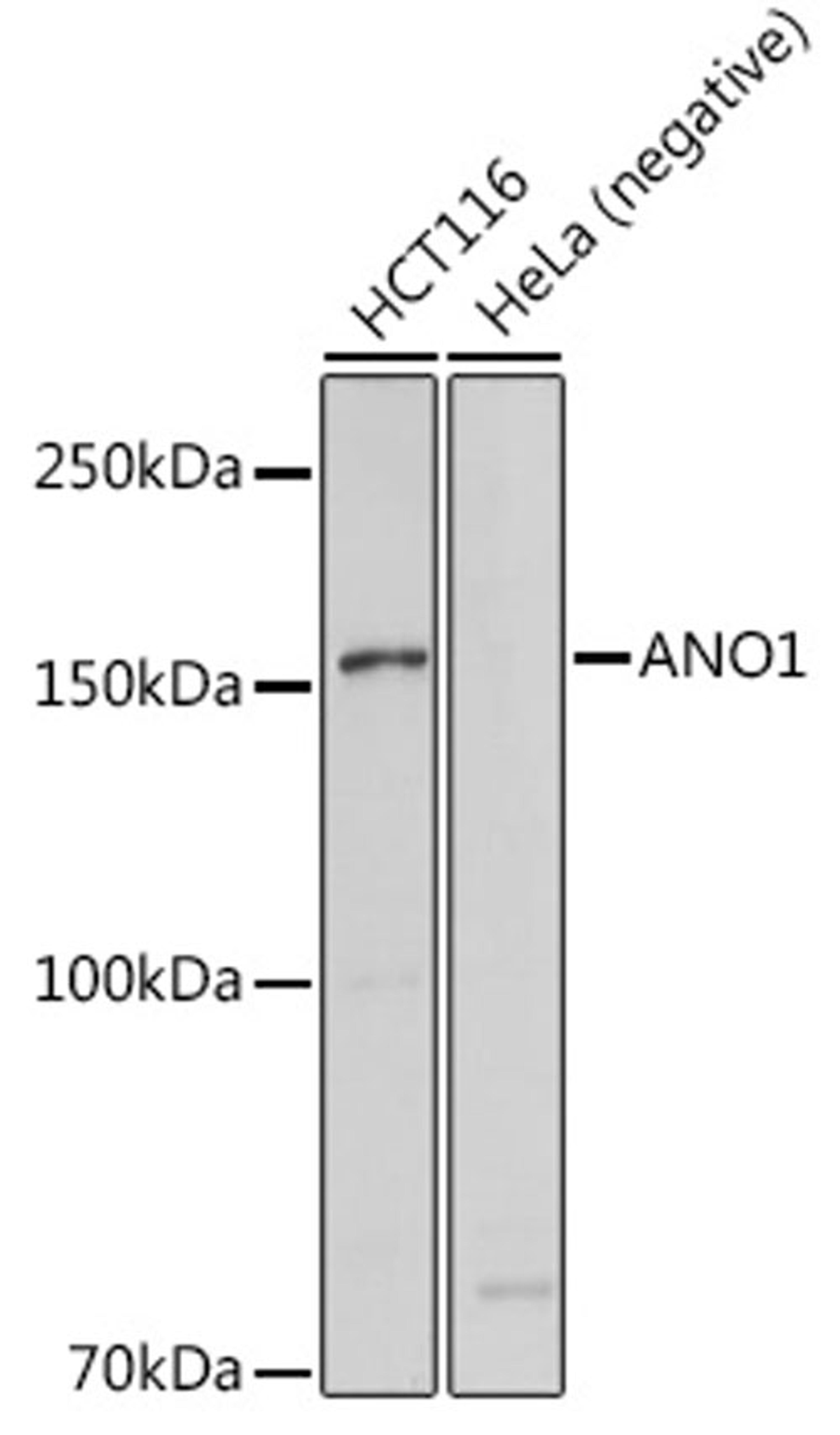 Western blot - ANO1 antibody (A10498)