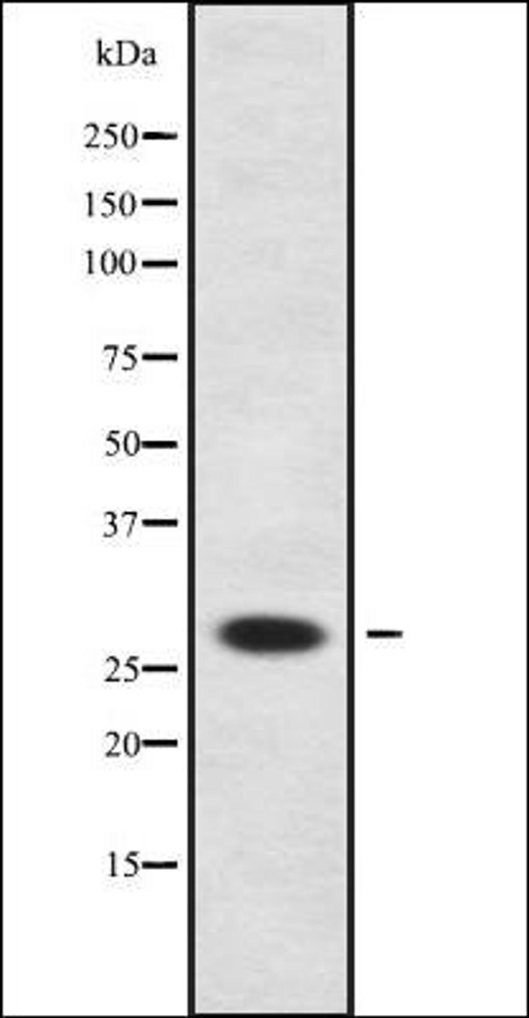 Western blot analysis of HeLa whole cell lysates using NEUROG2 antibody