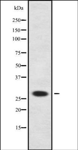 Western blot analysis of HeLa whole cell lysates using NEUROG2 antibody