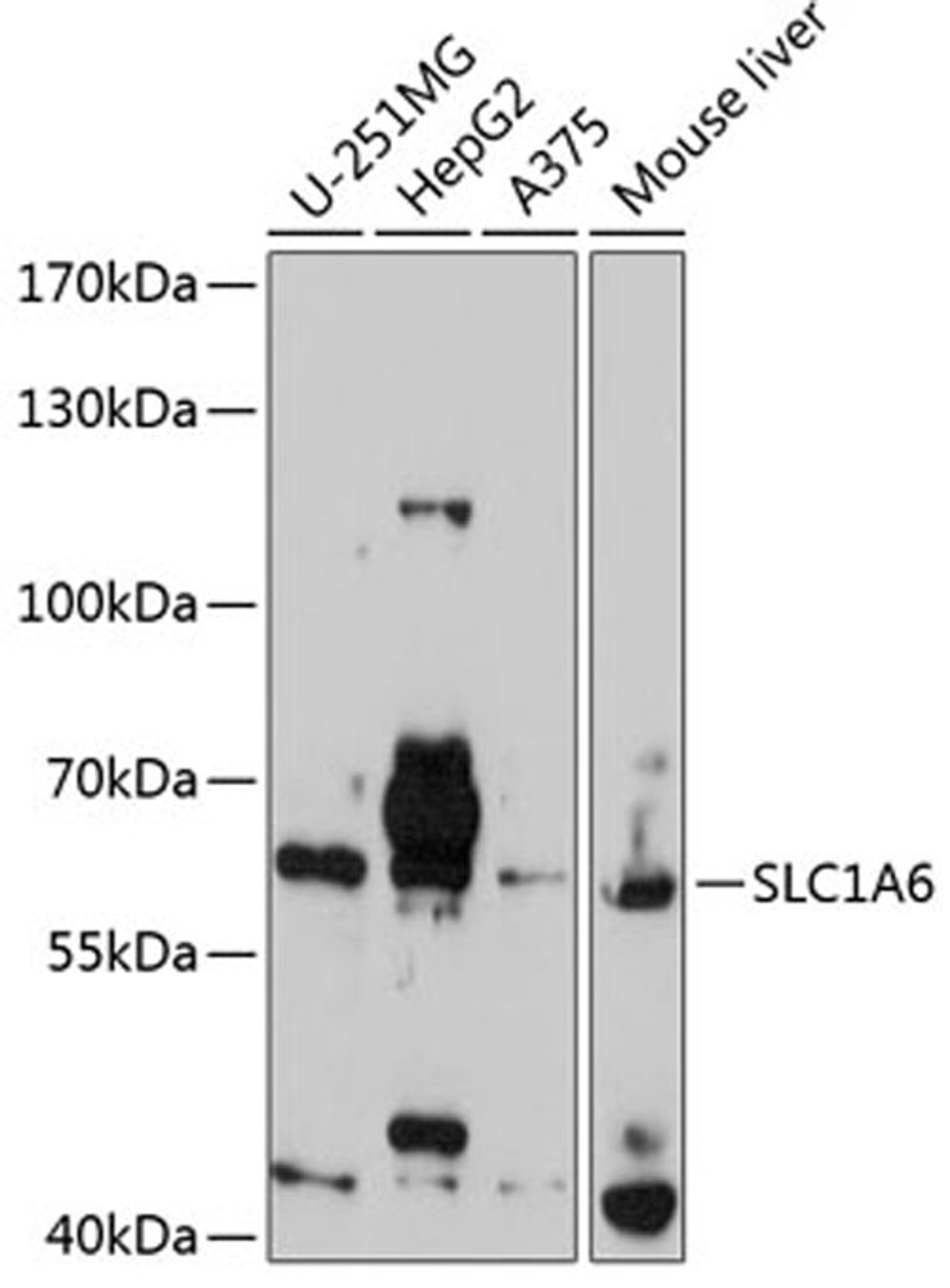 Western blot - SLC1A6 antibody (A2904)