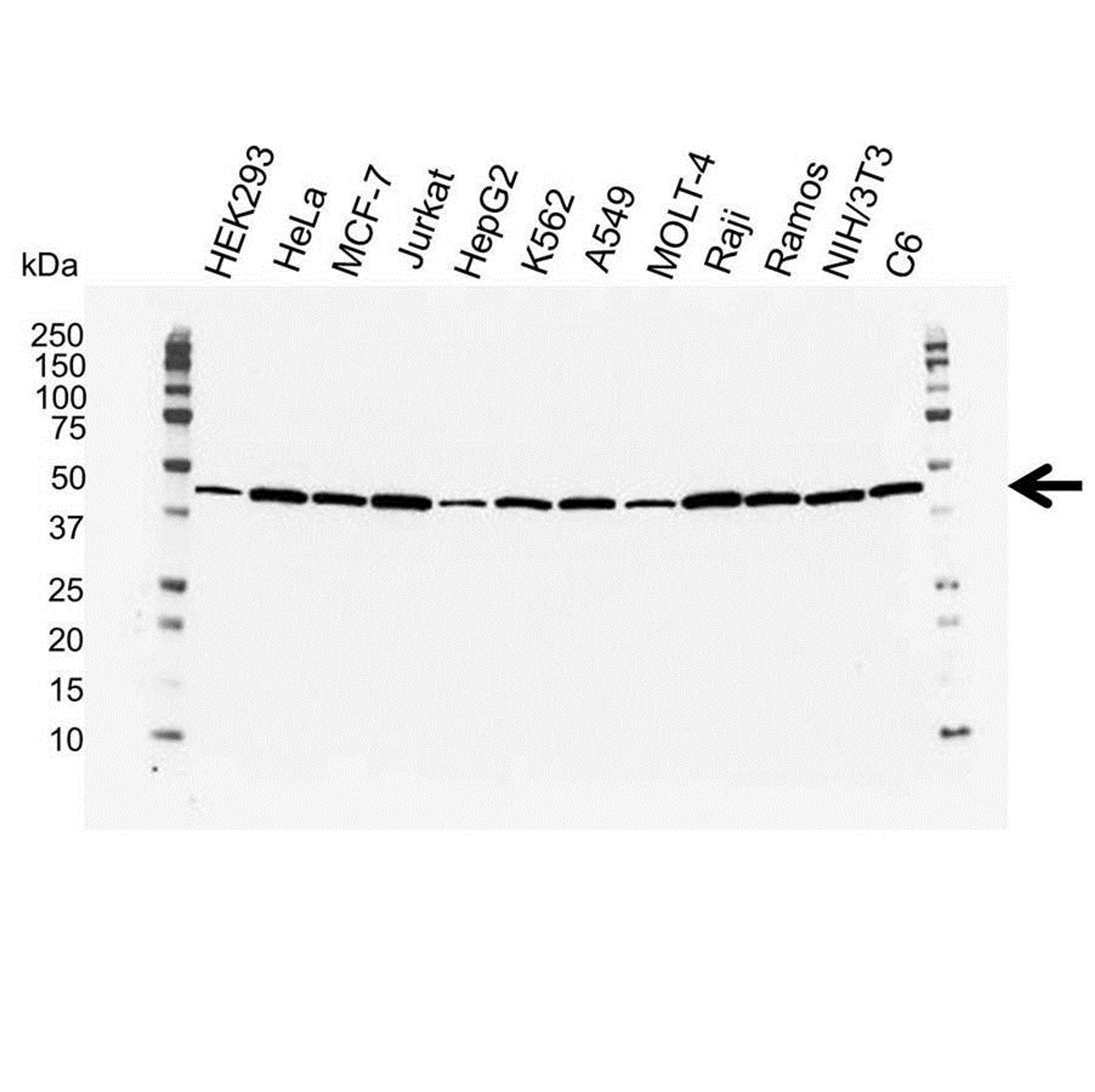 Western blot analysis of whole cell lysates