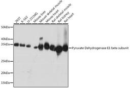 Western blot - Pyruvate Dehydrogenase E1 beta subunit Rabbit mAb (A4645)