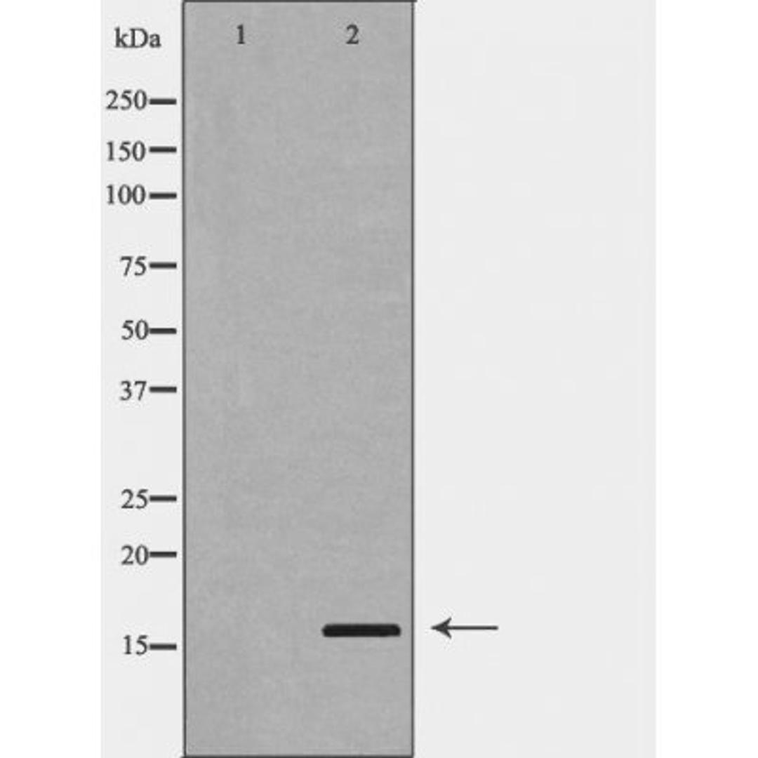 Western blot analysis of A549 cell and HeLacell lysate using PLA2G2A antibody