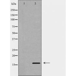 Western blot analysis of A549 cell and HeLacell lysate using PLA2G2A antibody