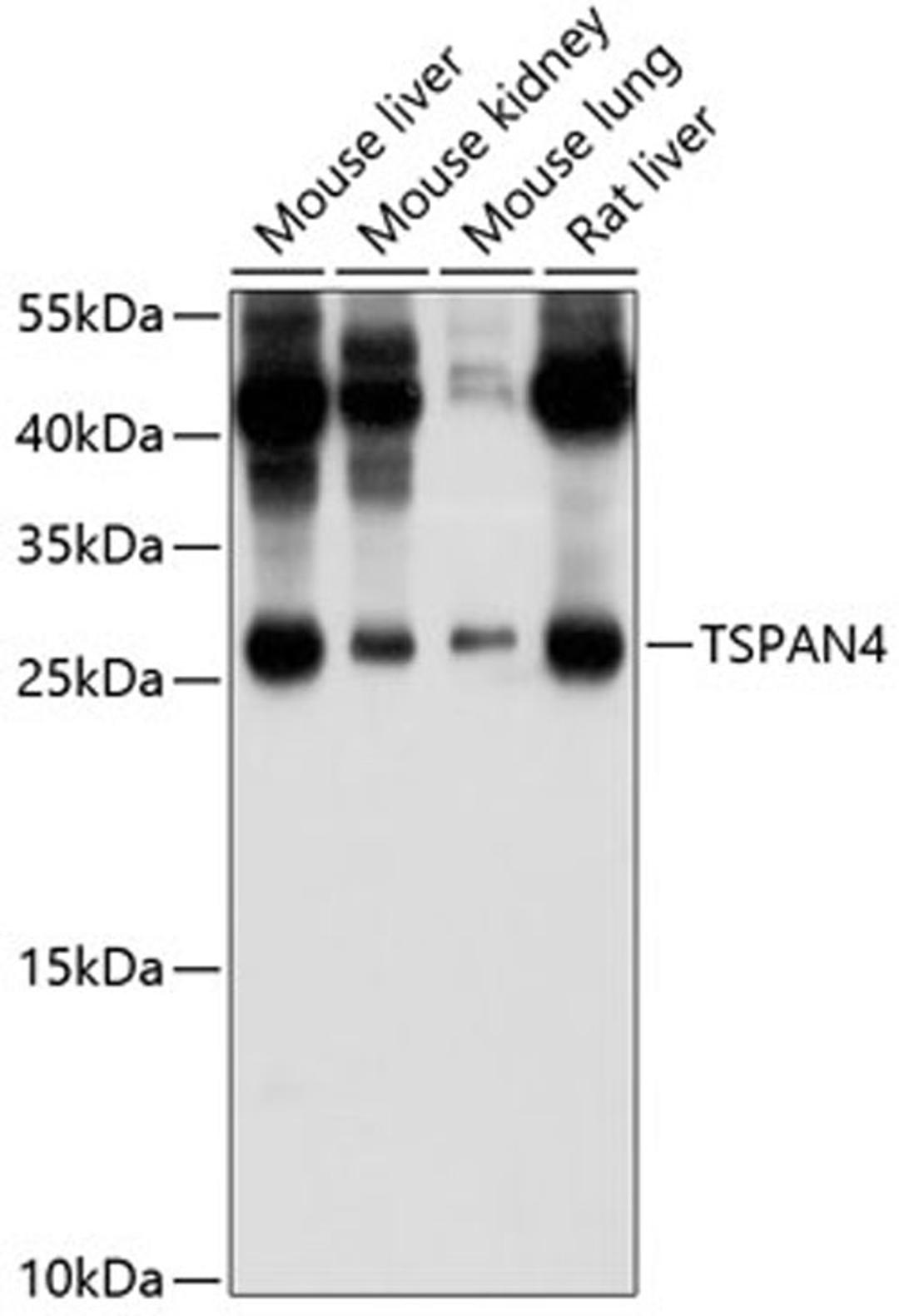 Western blot - TSPAN4 antibody (A10253)