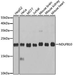 Western blot - NDUFB10 antibody (A3982)