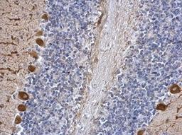 Immunohistochemistry-Paraffin: ICMT Antibody [NBP2-42865] - Analysis of mouse hind brain. ICMT antibody dilution: 1:500.