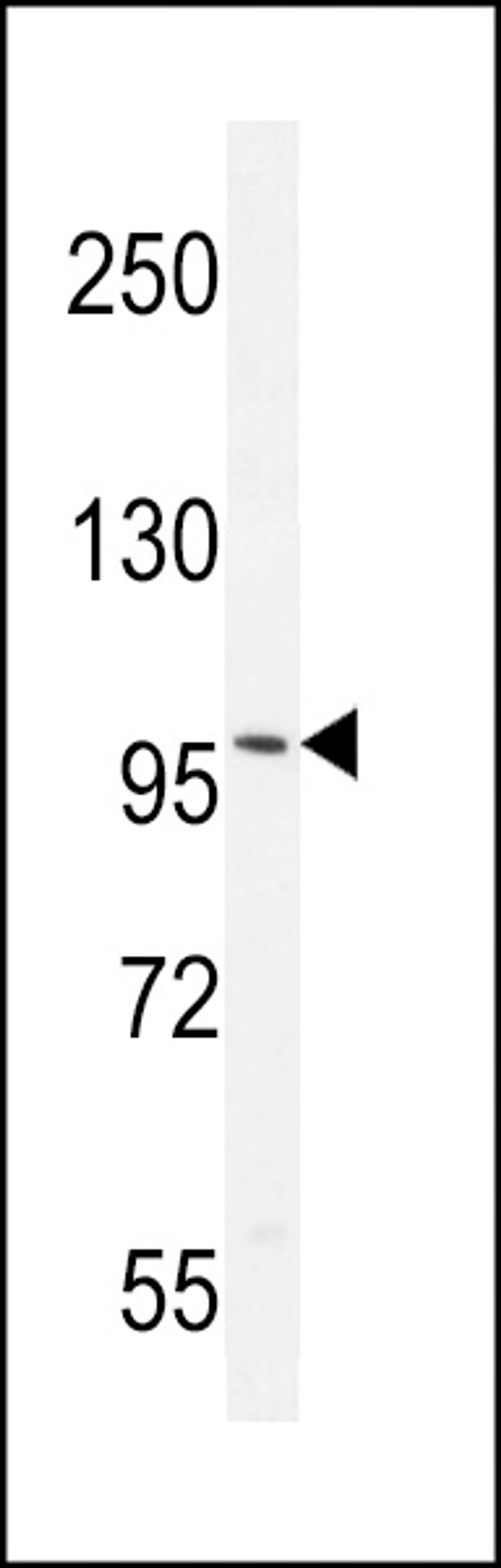 Western blot analysis in mouse brain tissue lysates (35ug/lane).This demonstrates the AR antibody detected the AR protein (arrow).