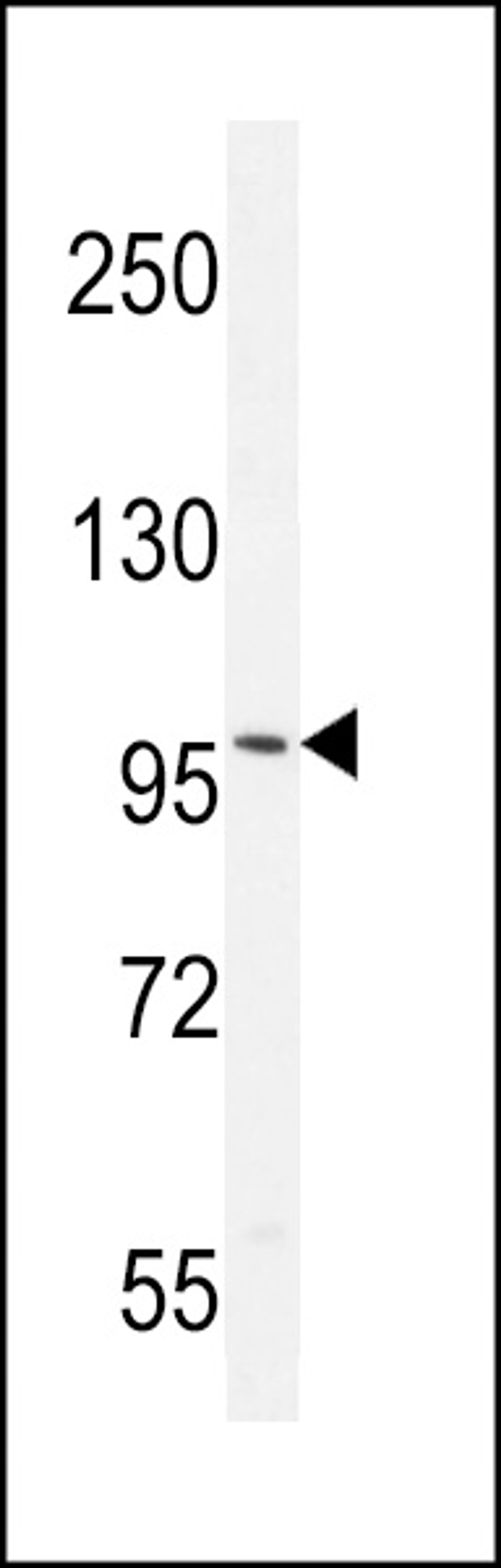 Western blot analysis in mouse brain tissue lysates (35ug/lane).This demonstrates the AR antibody detected the AR protein (arrow).