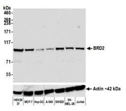 Detection of human BRD2 by western blot.