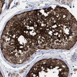 Immunohistochemistry: Chorein Antibody [NBP1-85641] - Staining of human testis shows strong cytoplasmic positivity in cells of seminiferus ducts.