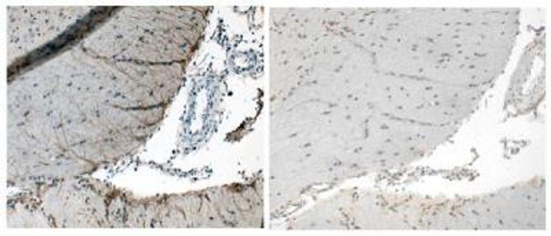 Immunohistochemistry: Corticotropin Releasing Factor Antibody [NB110-81721] - Immunohistochemical detection of Corticotropin Releasing Factor in Rat Hypothalamic Brain Tissue using a 1ug/ml dilution of Affinity Purified Sheep Anti-CRF . Left is tested using antibody. Right is testing using negative control antibody.