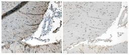 Immunohistochemistry: Corticotropin Releasing Factor Antibody [NB110-81721] - Immunohistochemical detection of Corticotropin Releasing Factor in Rat Hypothalamic Brain Tissue using a 1ug/ml dilution of Affinity Purified Sheep Anti-CRF . Left is tested using antibody. Right is testing using negative control antibody.