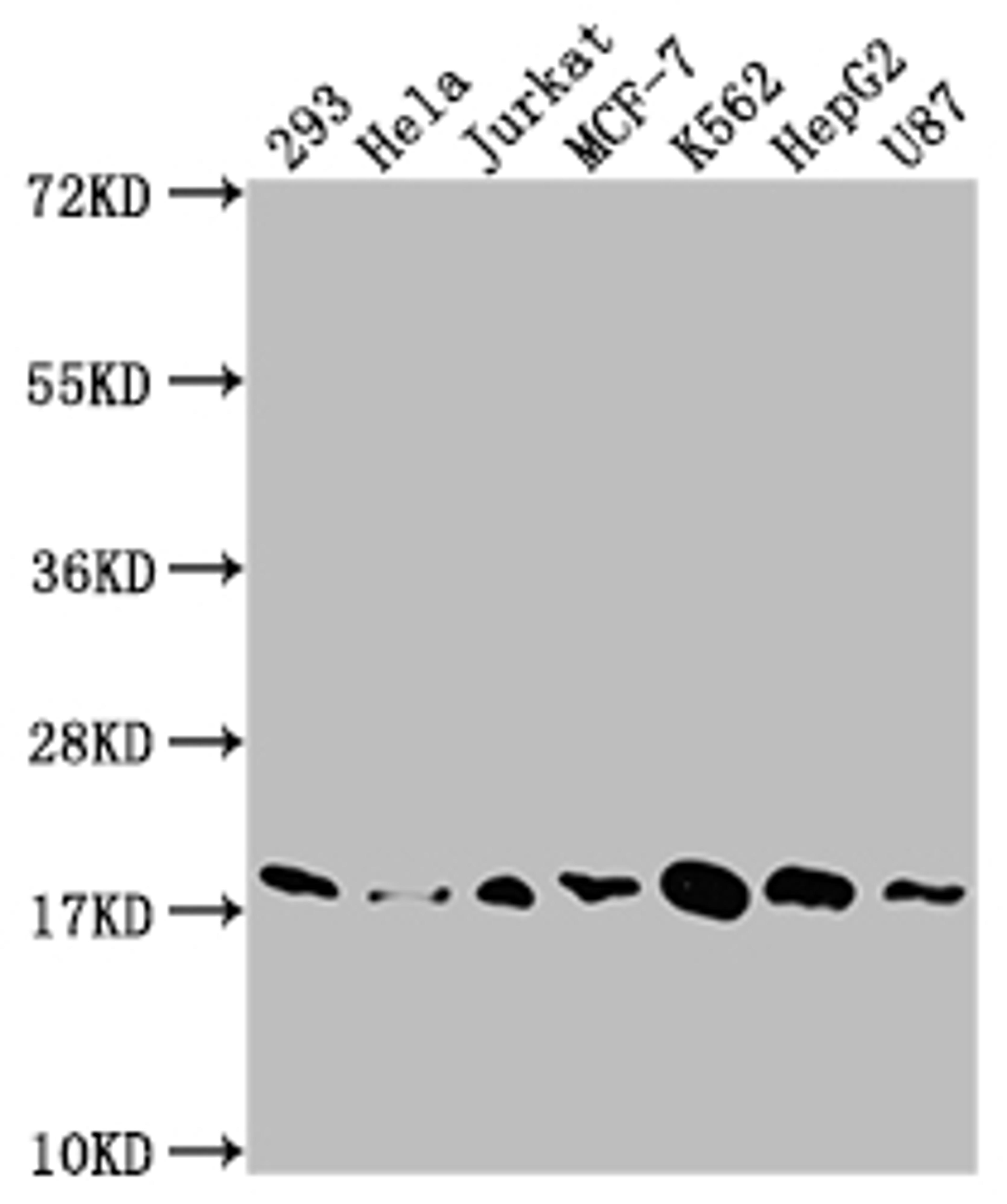 Western Blot. Positive WB detected in: 293 whole cell lysate, Hela whole cell lysate, Jurkat whole cell lysate, MCF-7 whole cell lysate, K562 whole cell lysate, HepG2 whole cell lysate, U87 whole cell lysate. All lanes: SOD1 antibody at 1:1500. Secondary. Goat polyclonal to rabbit IgG at 1/50000 dilution. Predicted band size: 16 kDa. Observed band size: 18 kDa. 