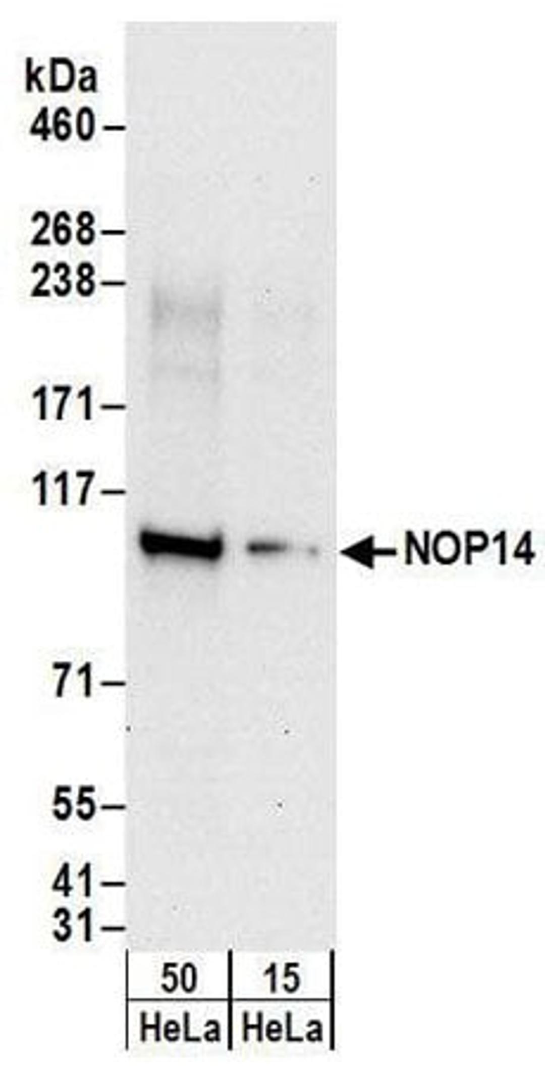 Detection of human NOP14 by western blot.