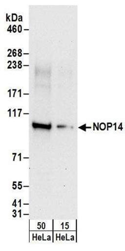 Detection of human NOP14 by western blot.