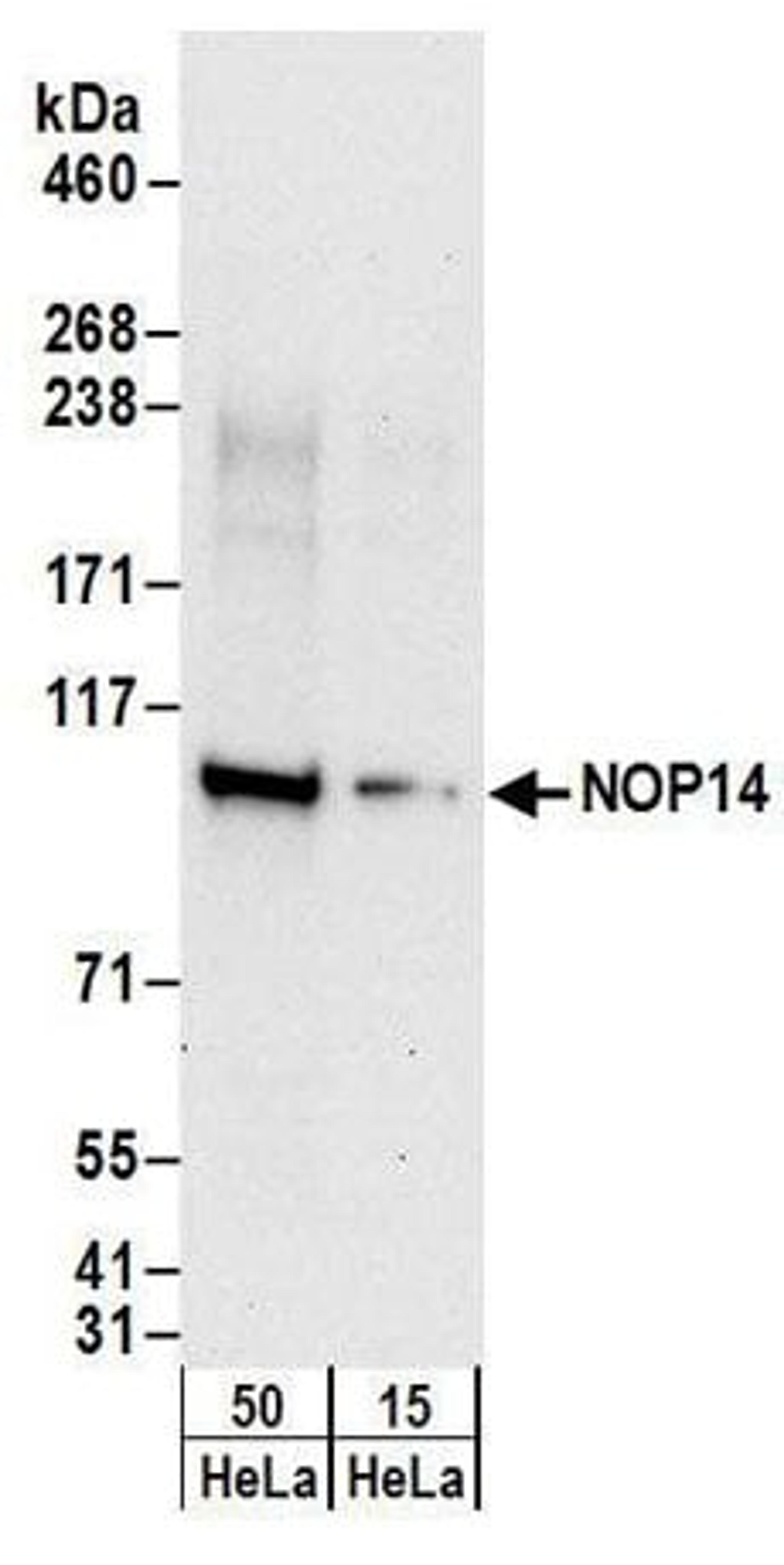 Detection of human NOP14 by western blot.