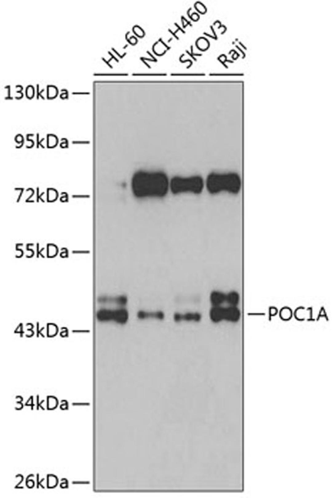 Western blot - POC1A antibody (A7465)