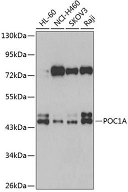 Western blot - POC1A antibody (A7465)