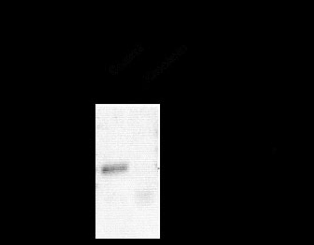 GABA A Receptor alpha 1, CT Antibody