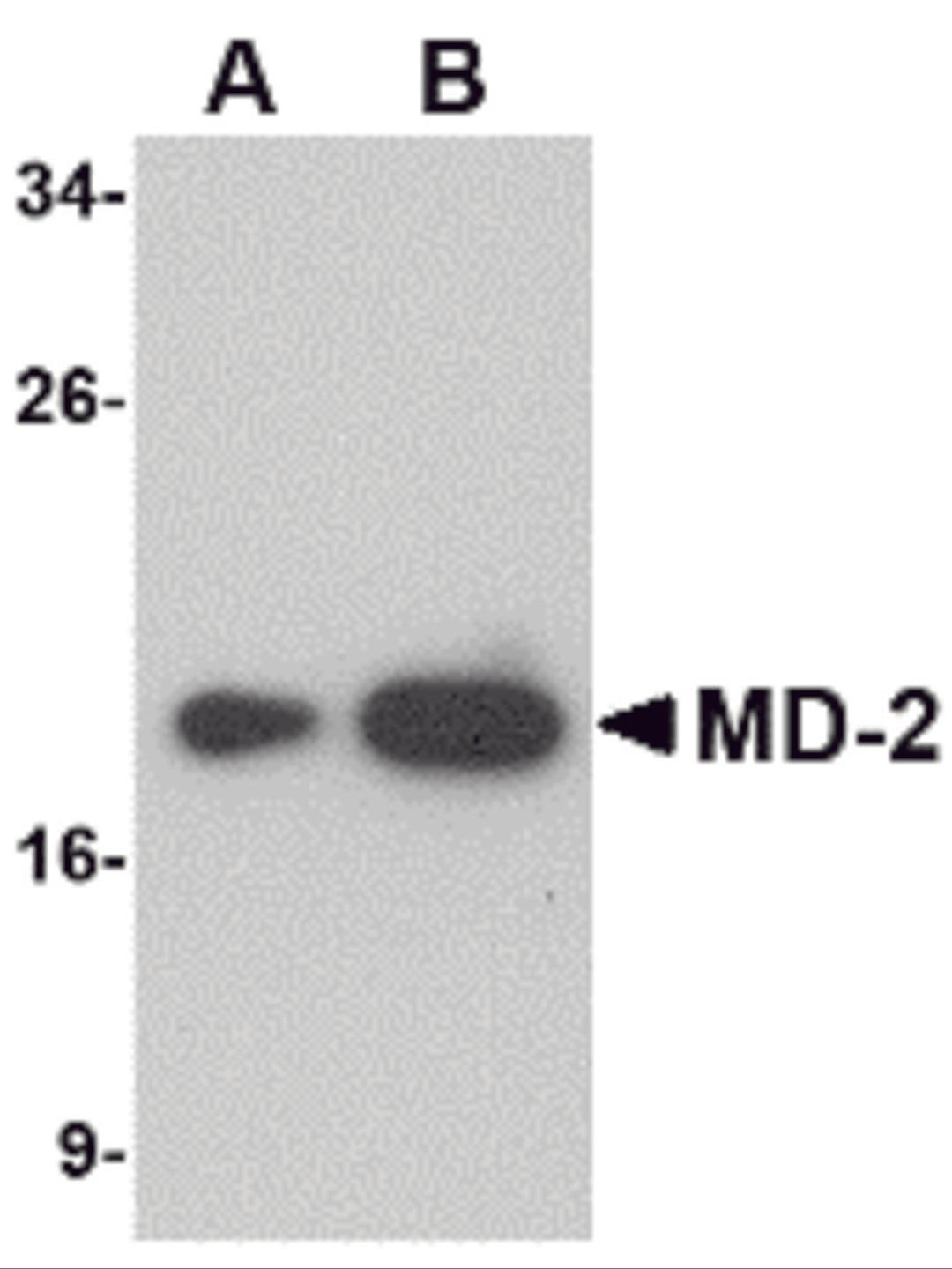 Western blot analysis of (A) 25 and (B) 125 ng of MD-2 recombinant protein with MD-2 antibody at 1 &#956;g/mL.