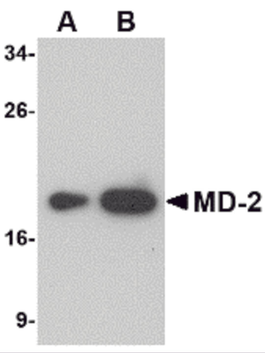 Western blot analysis of (A) 25 and (B) 125 ng of MD-2 recombinant protein with MD-2 antibody at 1 μg/mL.