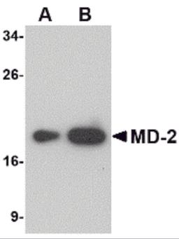Western blot analysis of (A) 25 and (B) 125 ng of MD-2 recombinant protein with MD-2 antibody at 1 μg/mL.